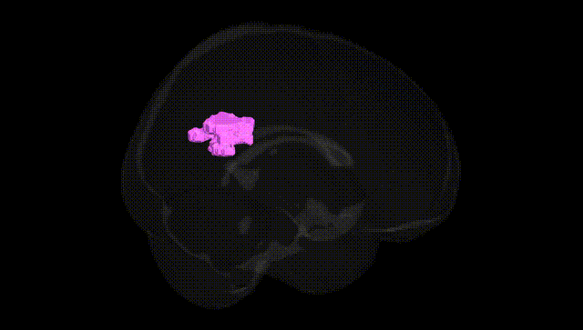 Full Brain Black