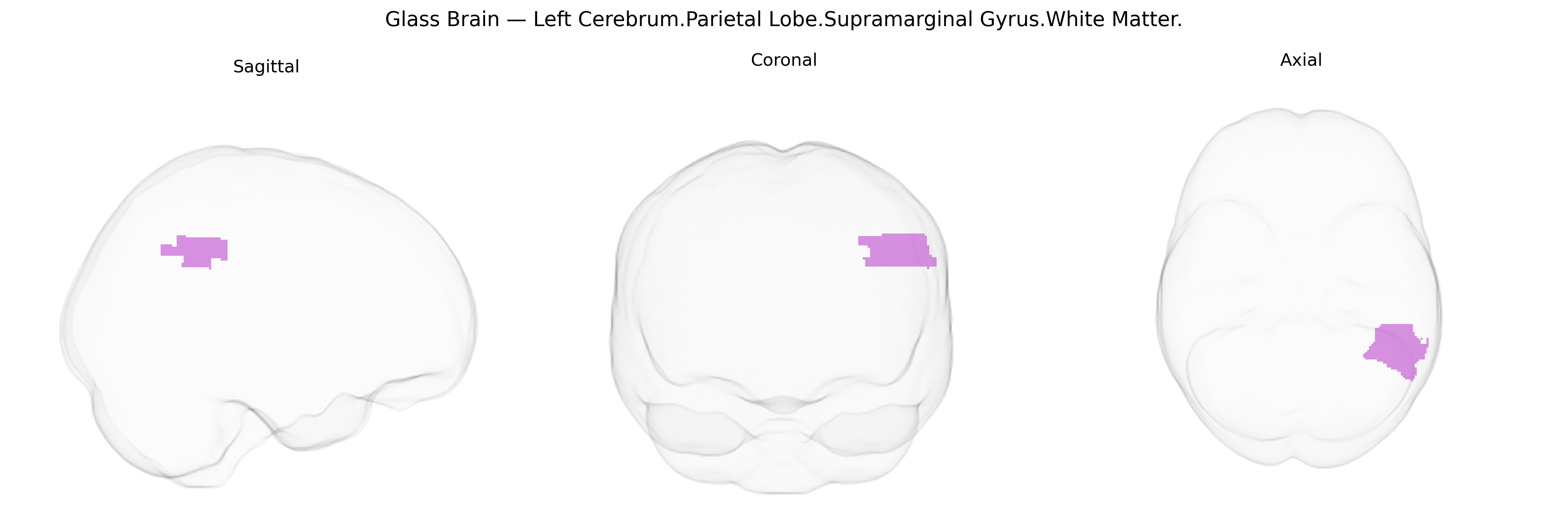 Triplanar Ghost Brain