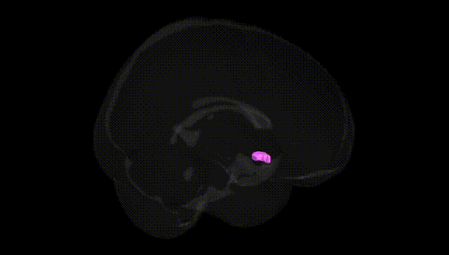 Full Brain Black