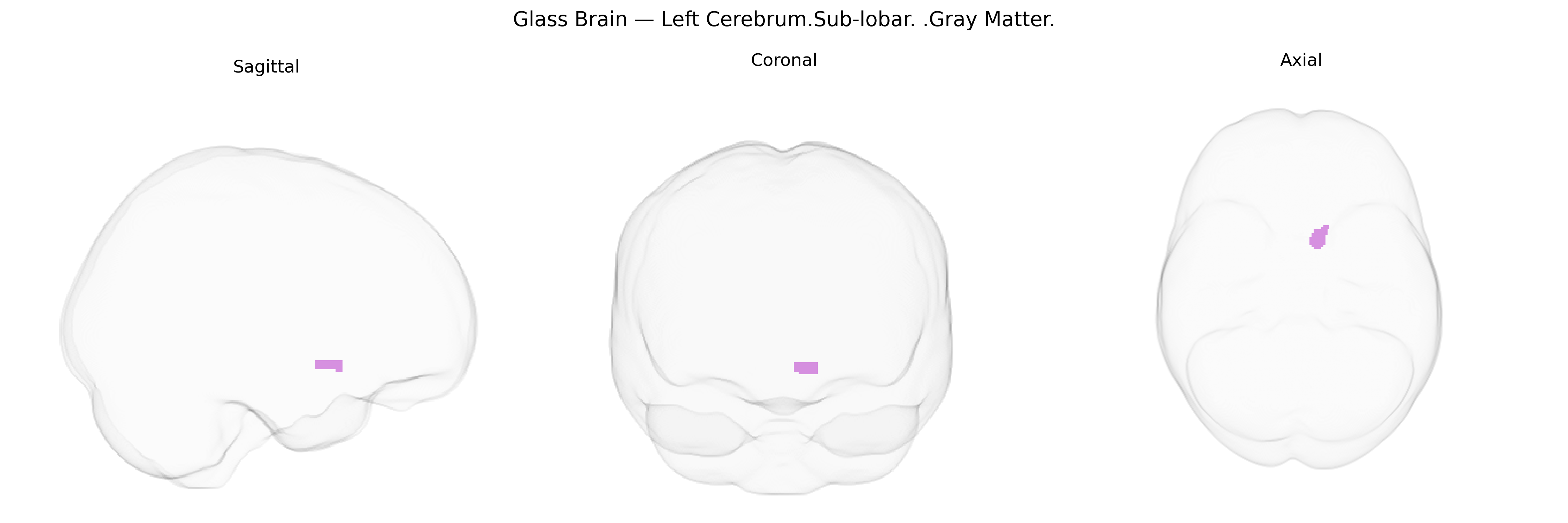 Triplanar Ghost Brain