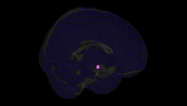 Full Brain Black