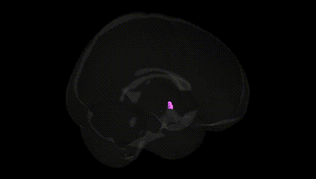 Full Brain Black