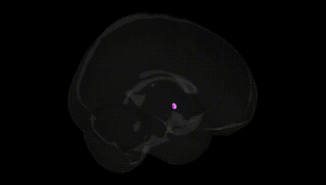 Full Brain Black