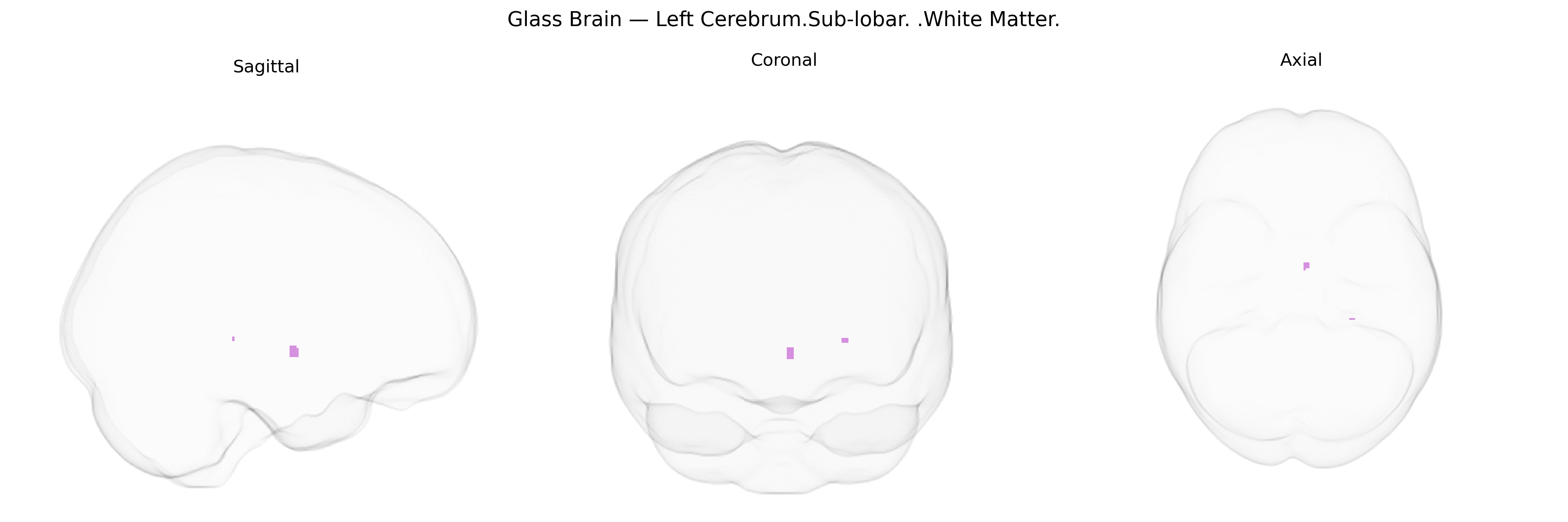 Triplanar Ghost Brain