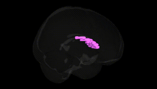Full Brain Black