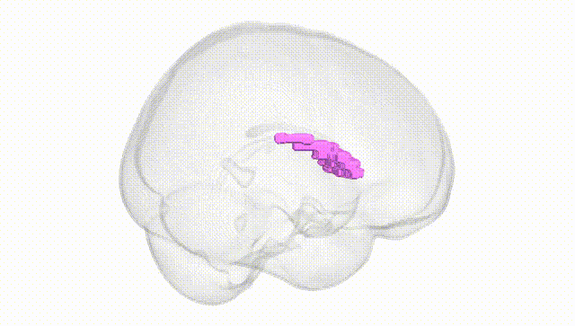 Full Brain White