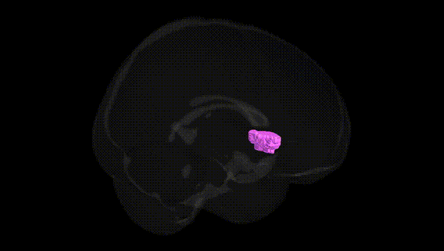 Full Brain Black
