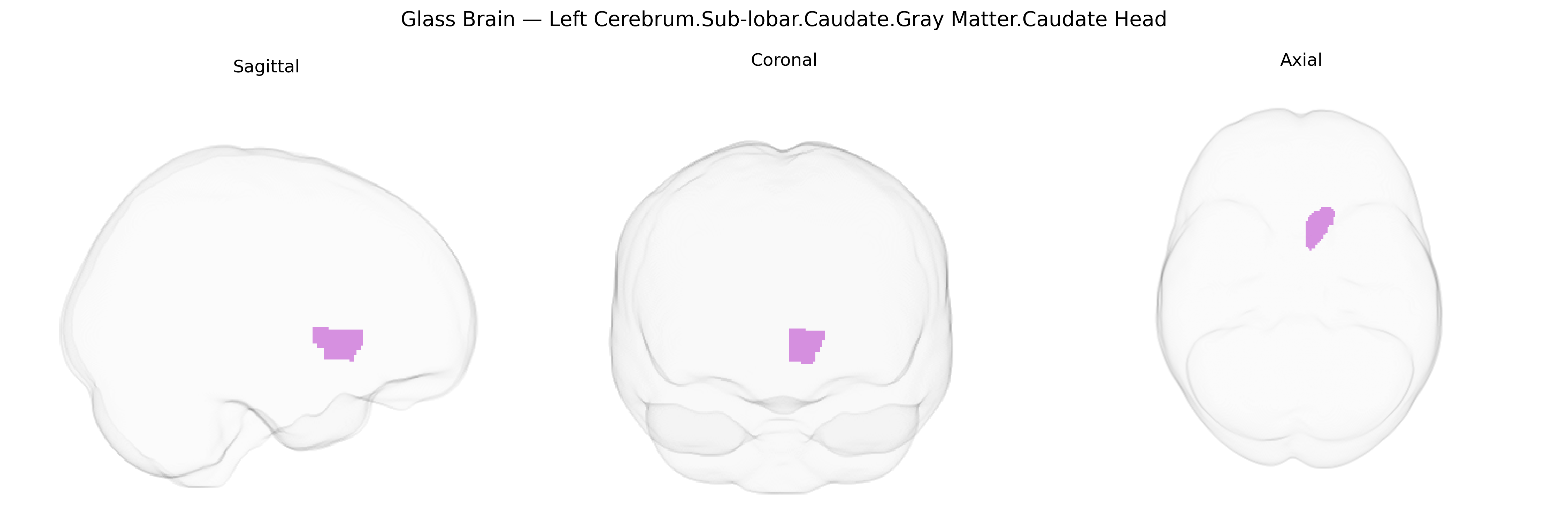 Triplanar Ghost Brain