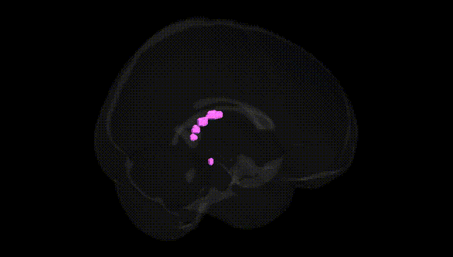 Full Brain Black
