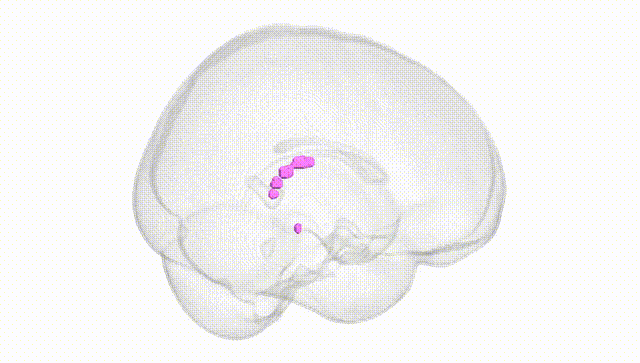 Full Brain White