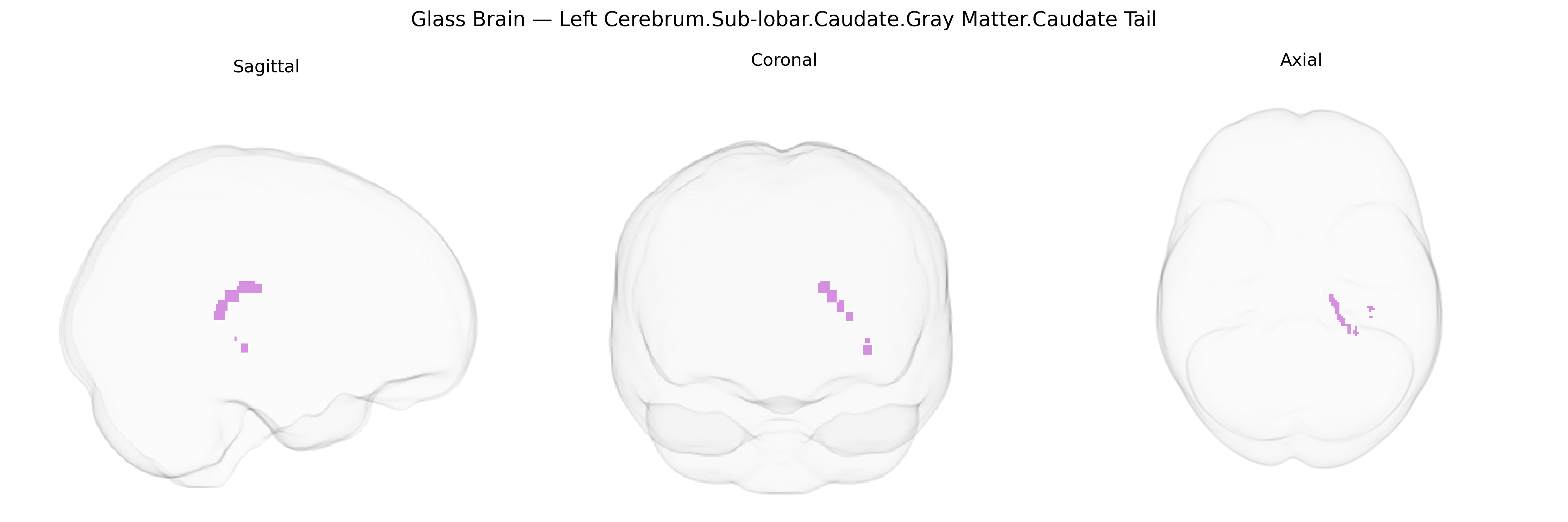 Triplanar Ghost Brain