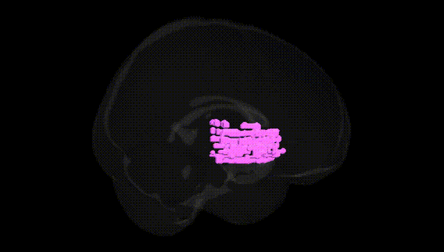 Full Brain Black