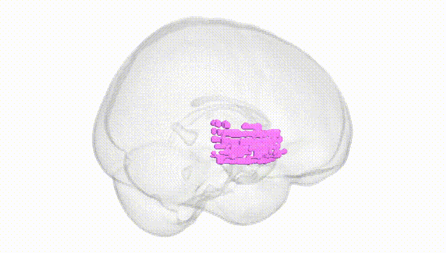 Full Brain White