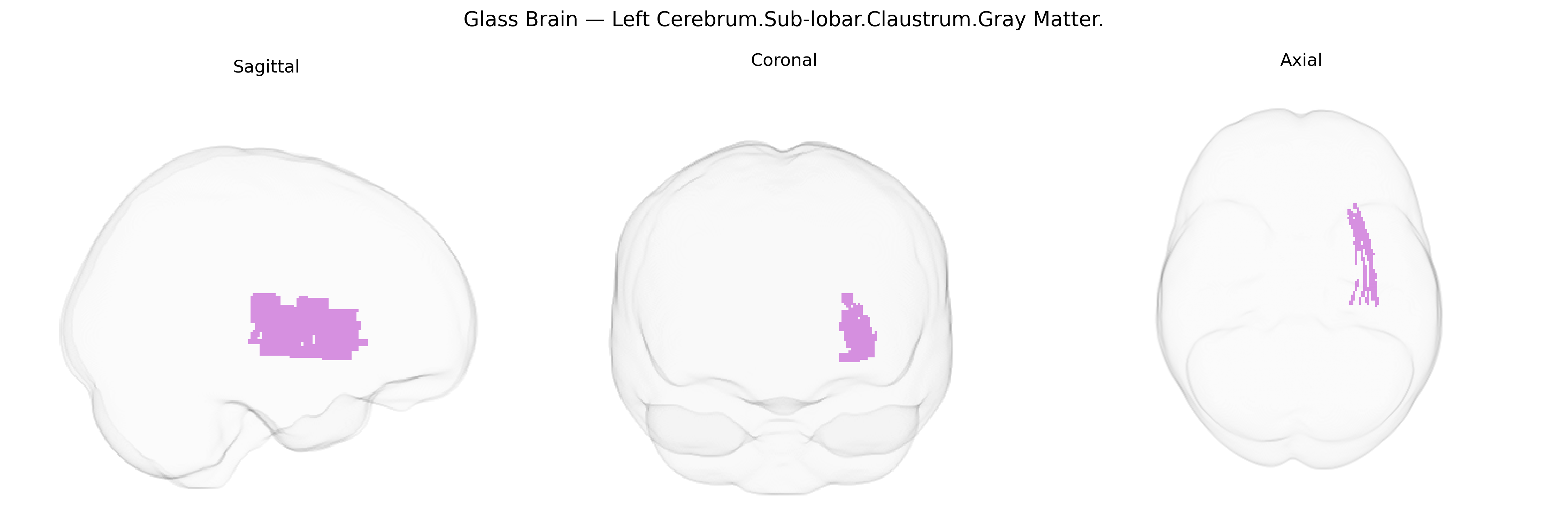 Triplanar Ghost Brain
