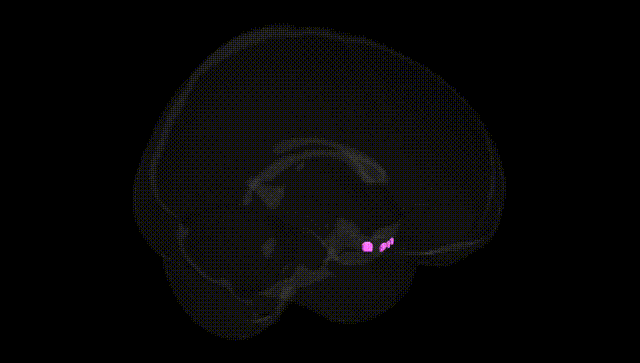 Full Brain Black