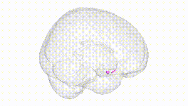 Full Brain White