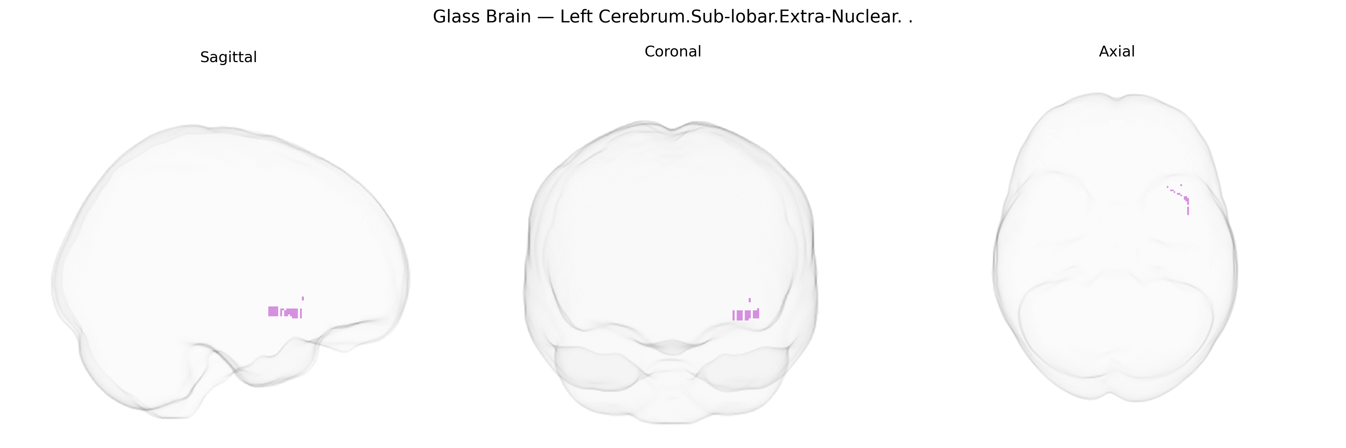 Triplanar Ghost Brain
