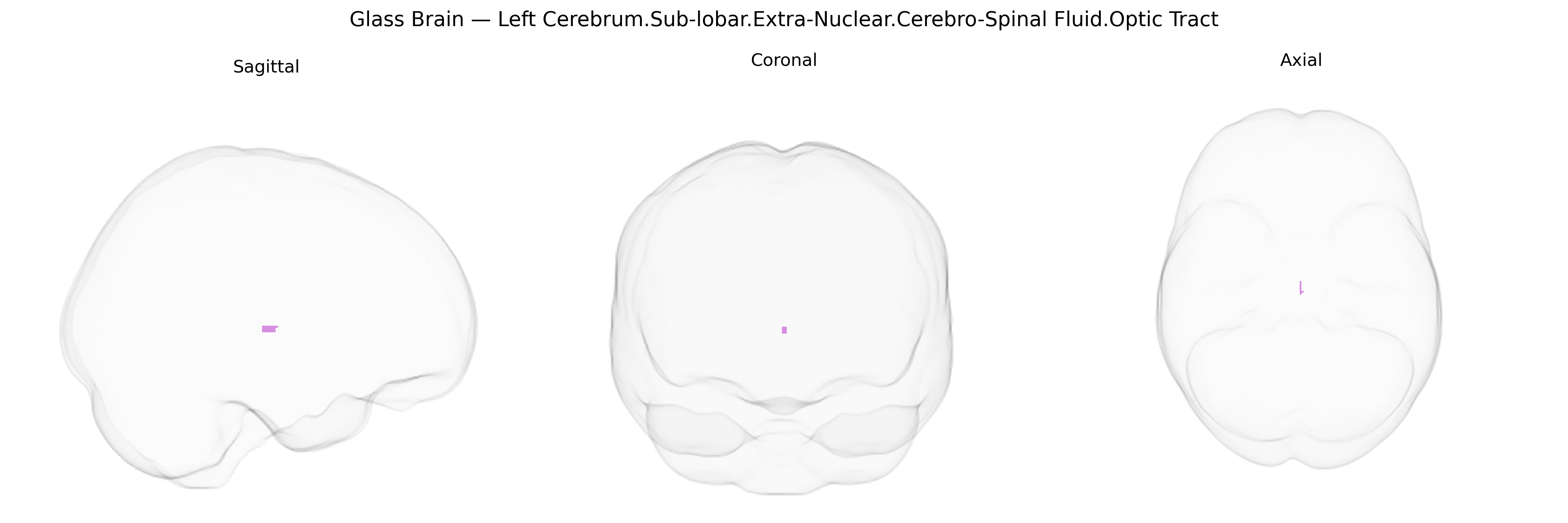 Triplanar Ghost Brain