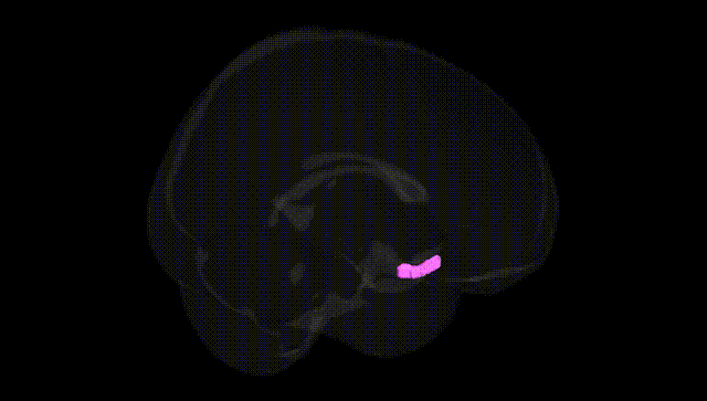 Full Brain Black