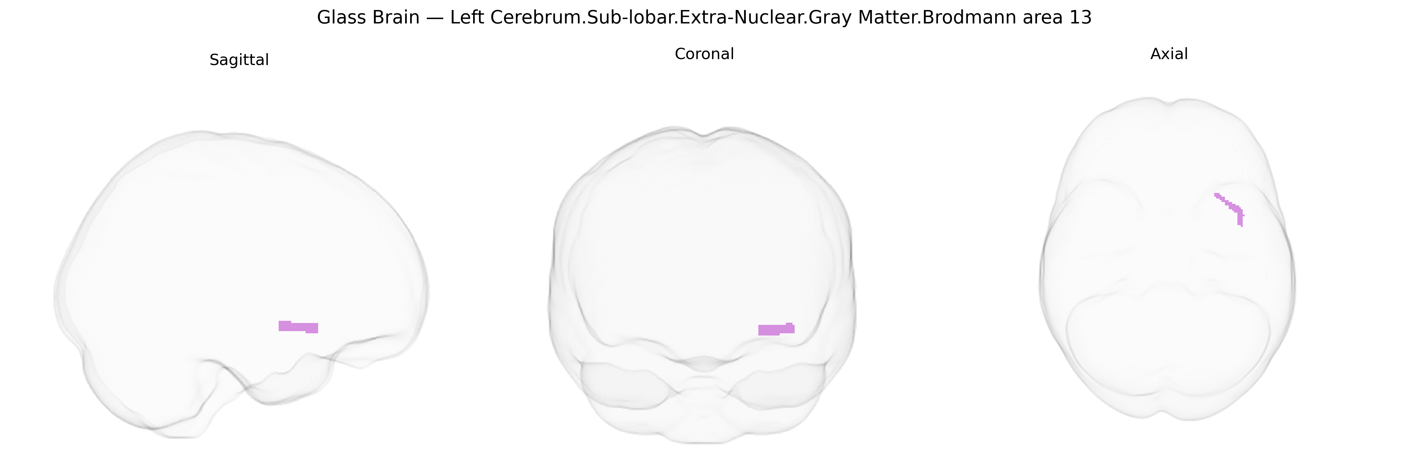 Triplanar Ghost Brain