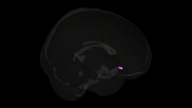 Full Brain Black
