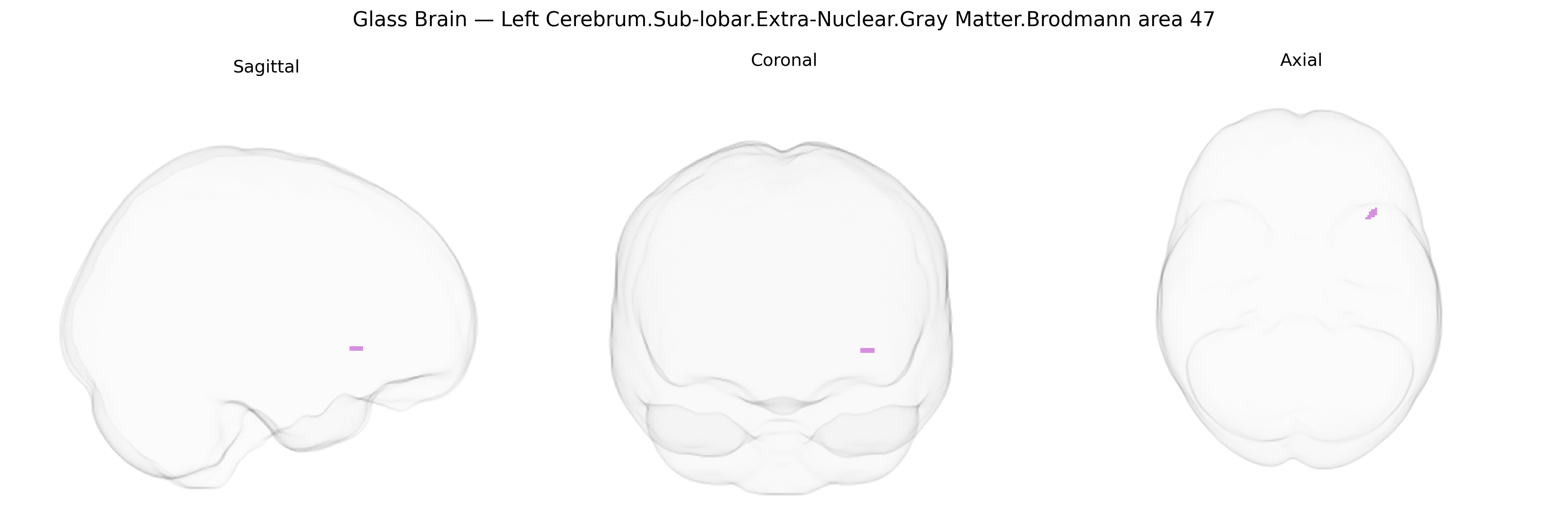 Triplanar Ghost Brain