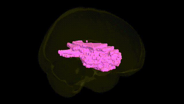 Full Brain Black