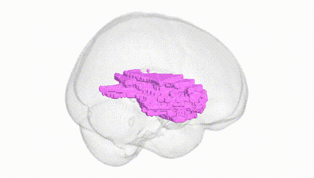 Full Brain White