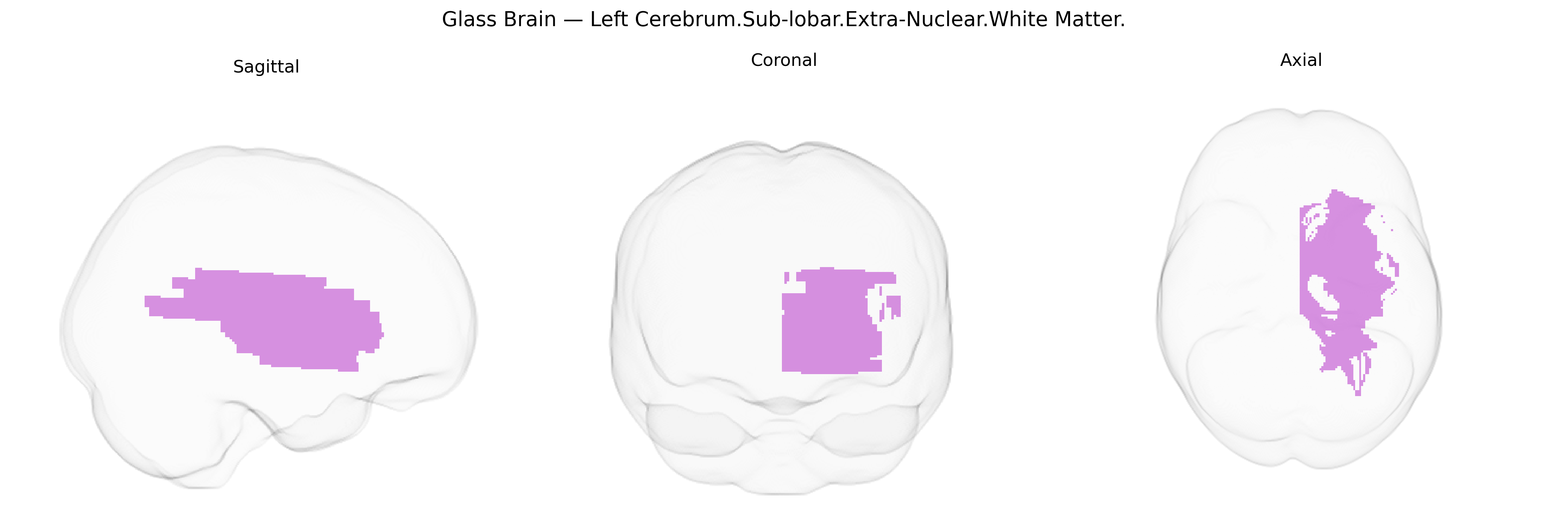 Triplanar Ghost Brain