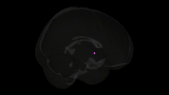 Full Brain Black