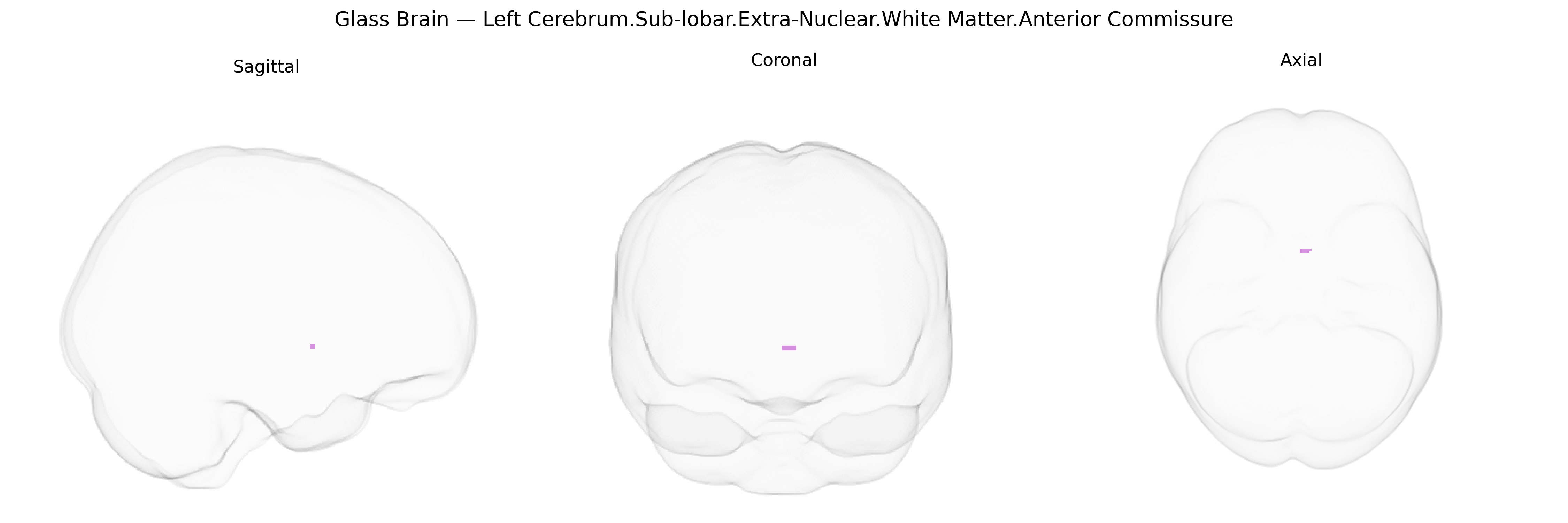 Triplanar Ghost Brain