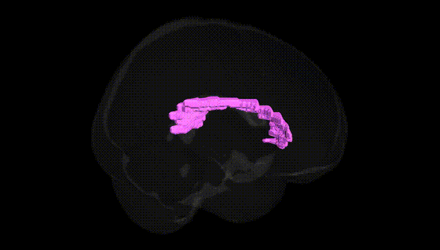 Full Brain Black