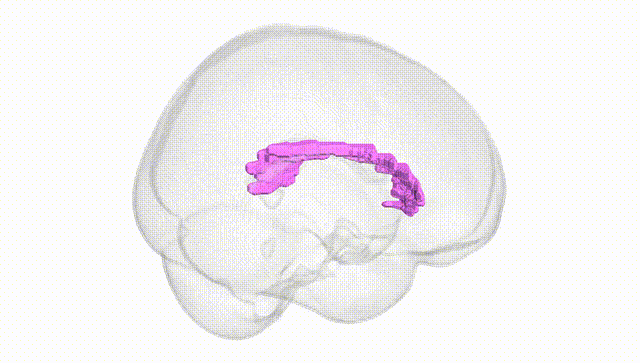 Full Brain White
