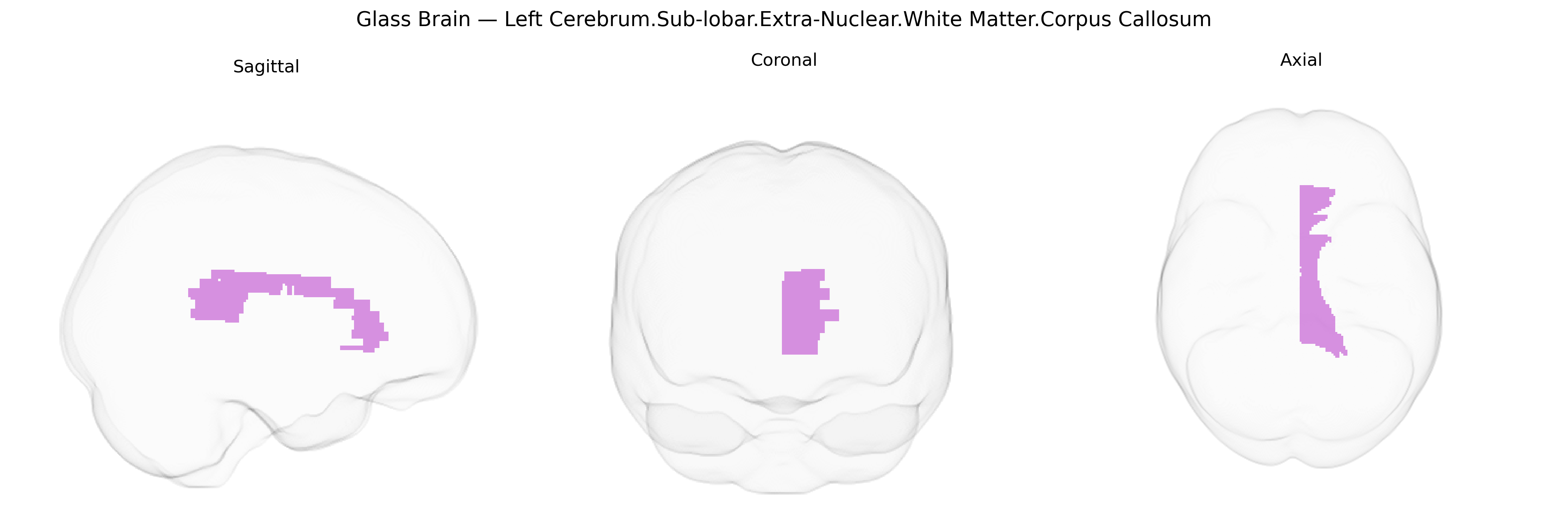 Triplanar Ghost Brain