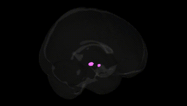 Full Brain Black
