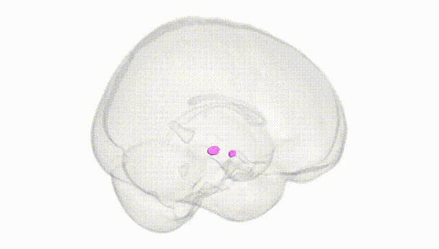 Full Brain White