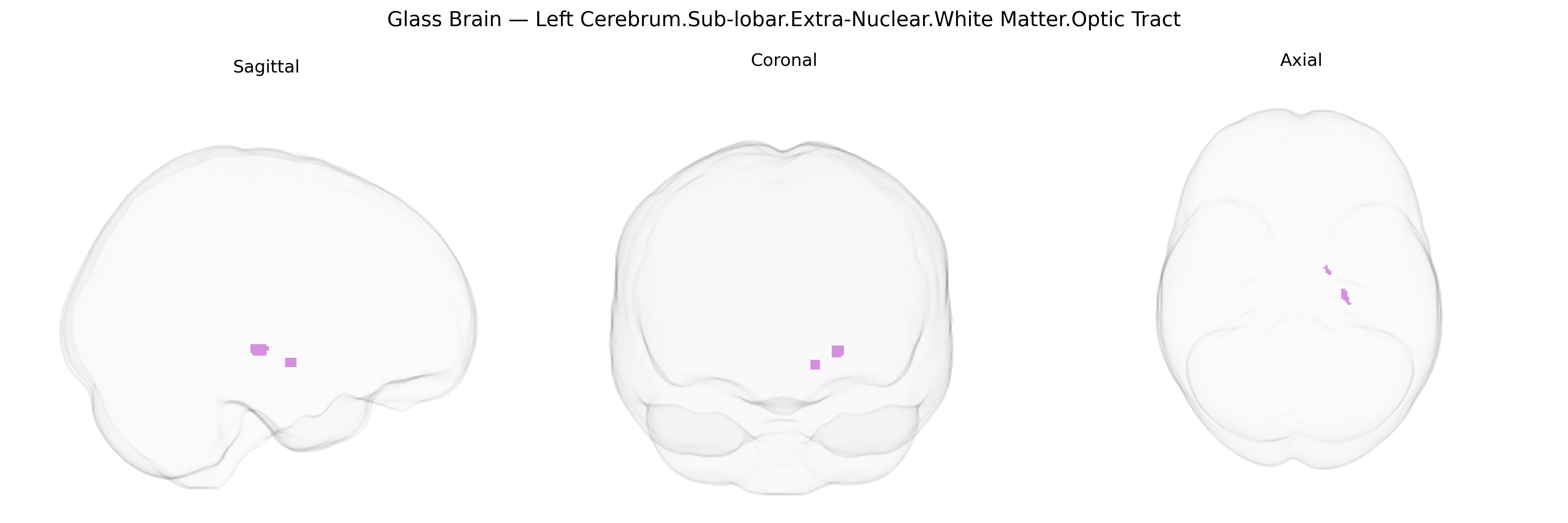 Triplanar Ghost Brain