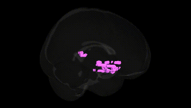 Full Brain Black