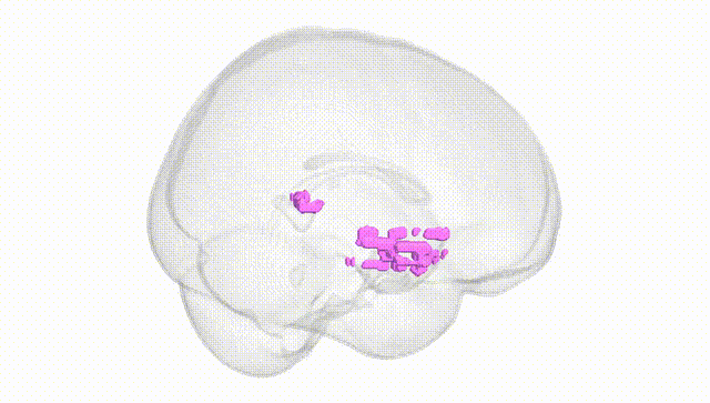 Full Brain White