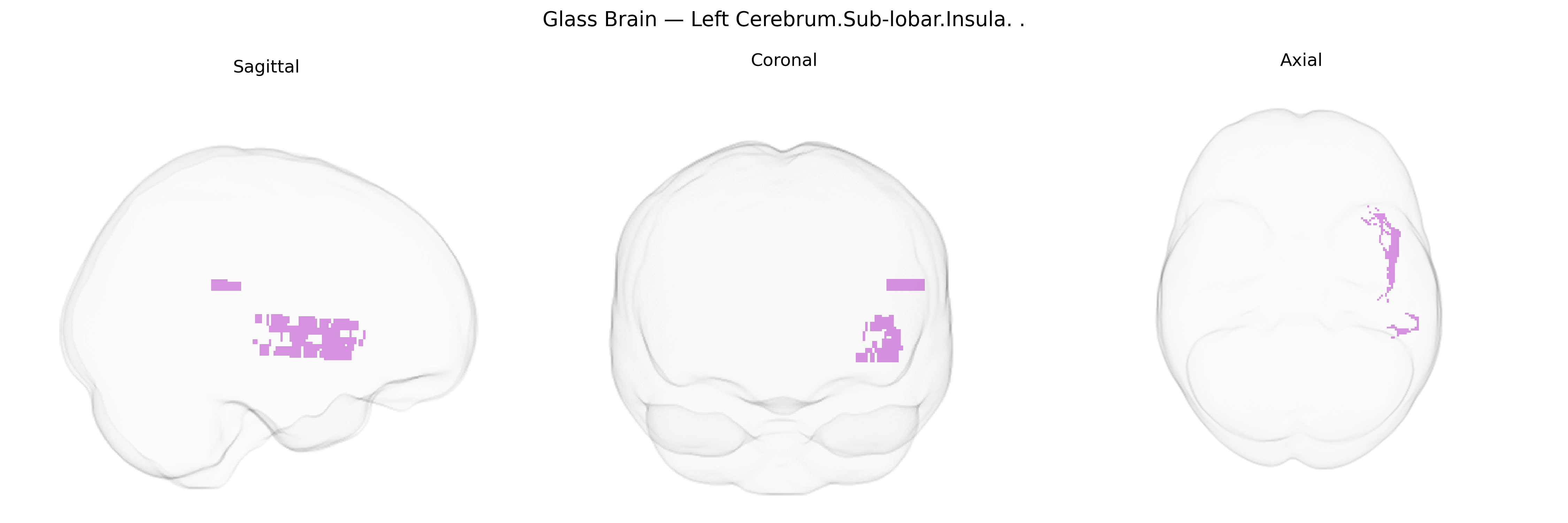 Triplanar Ghost Brain