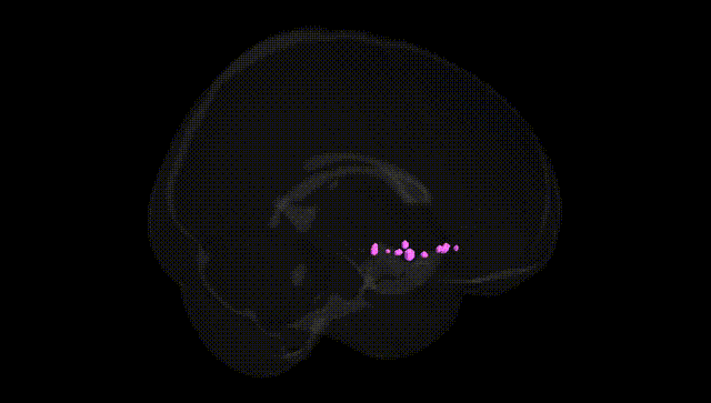 Full Brain Black