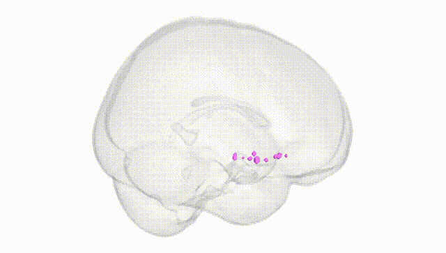 Full Brain White