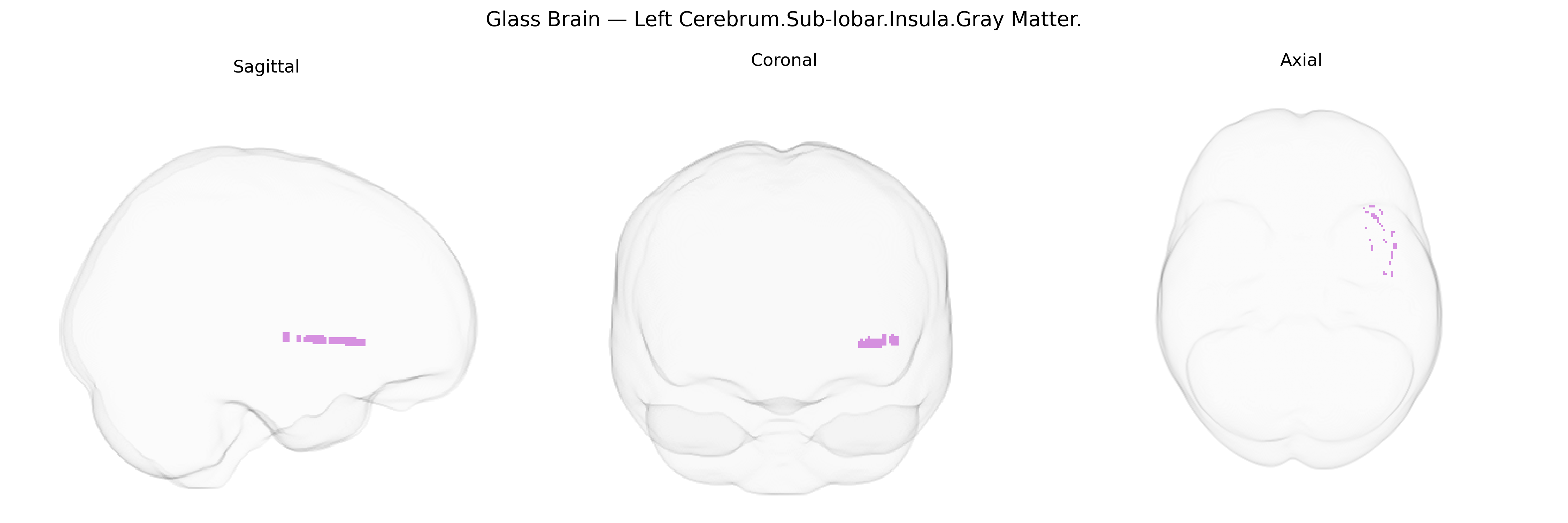 Triplanar Ghost Brain