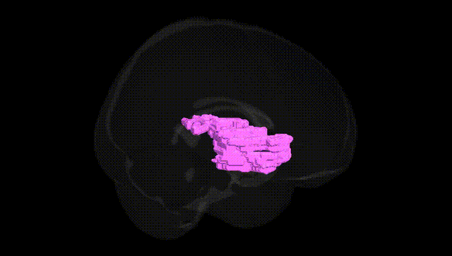 Full Brain Black