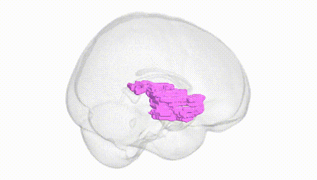 Full Brain White
