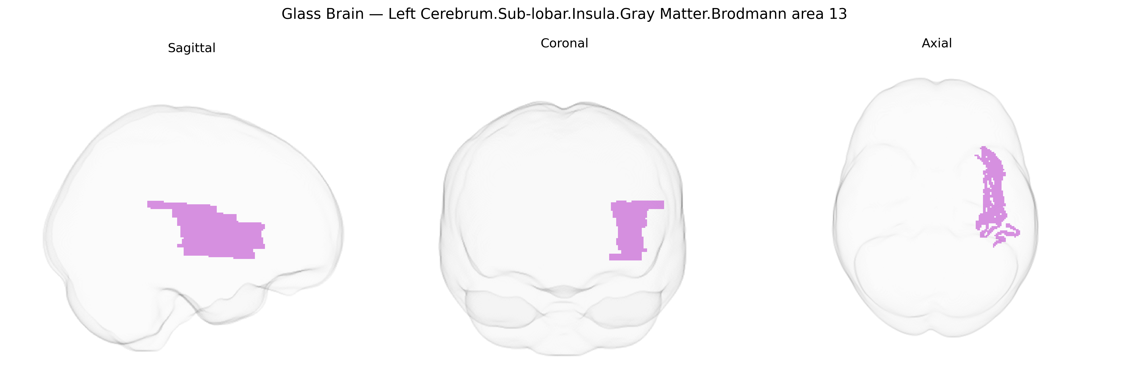 Triplanar Ghost Brain