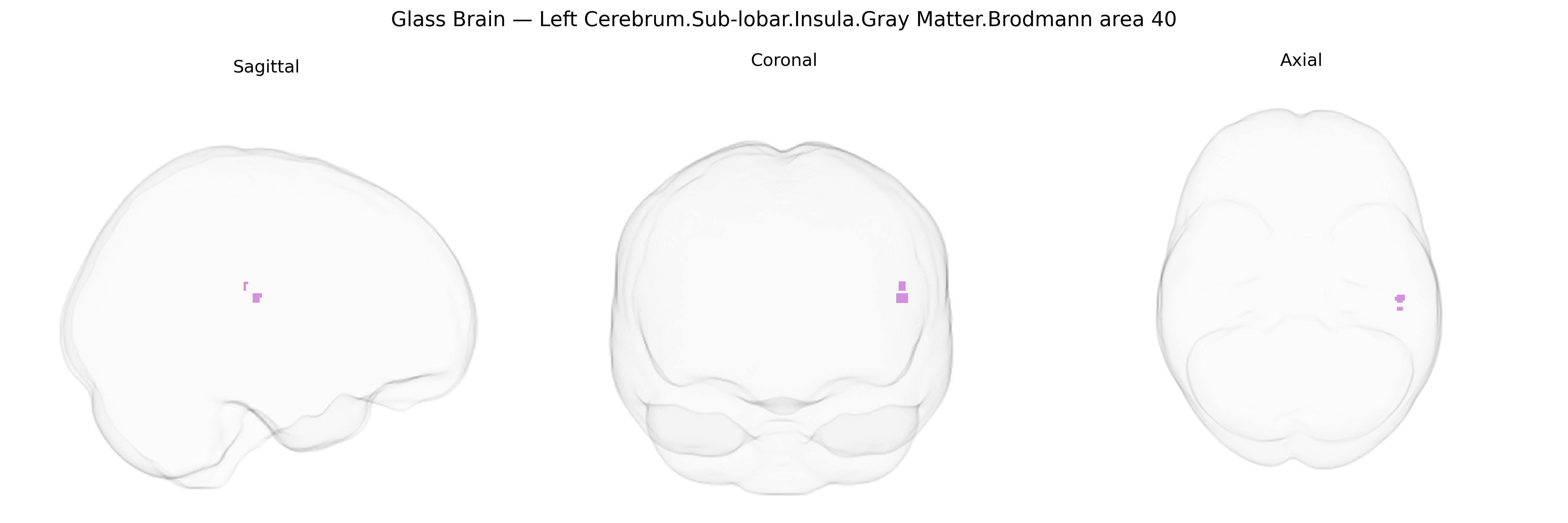 Triplanar Ghost Brain