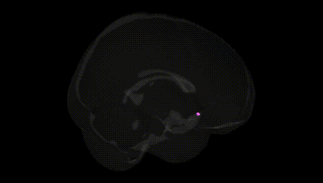Full Brain Black