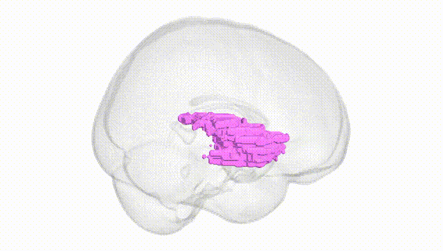 Full Brain White