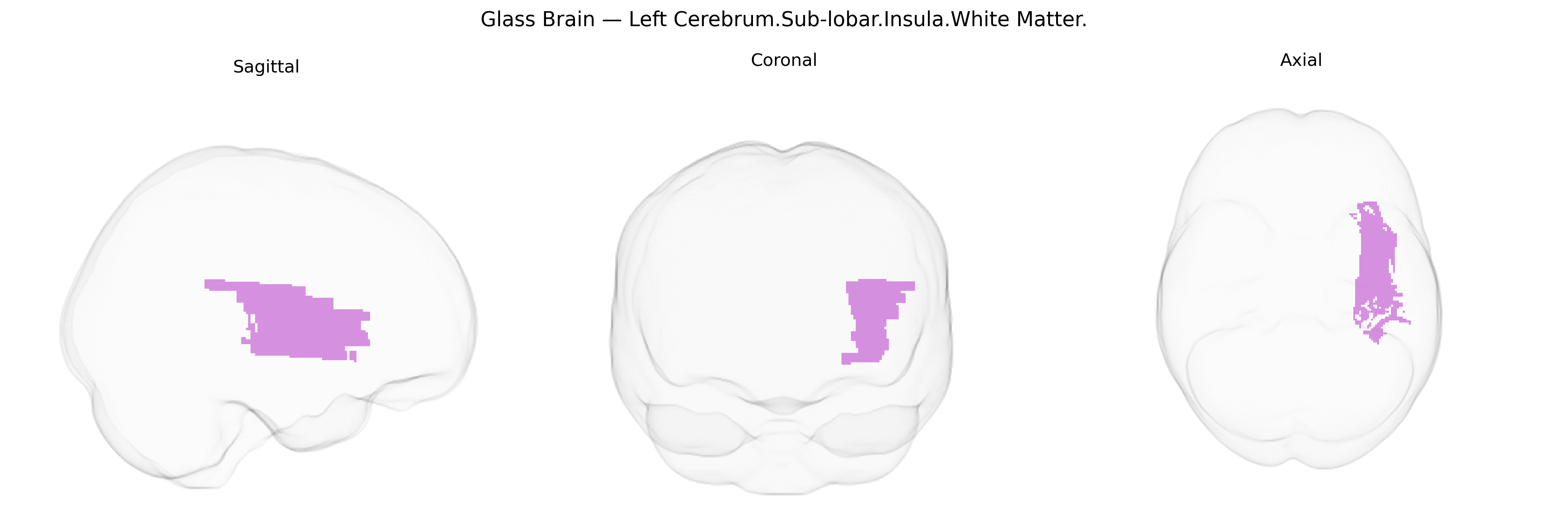 Triplanar Ghost Brain